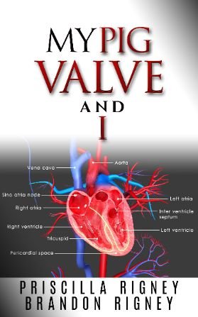 My Pig Valve and I: Surviving 19 Years With An Artificial Heart Valve